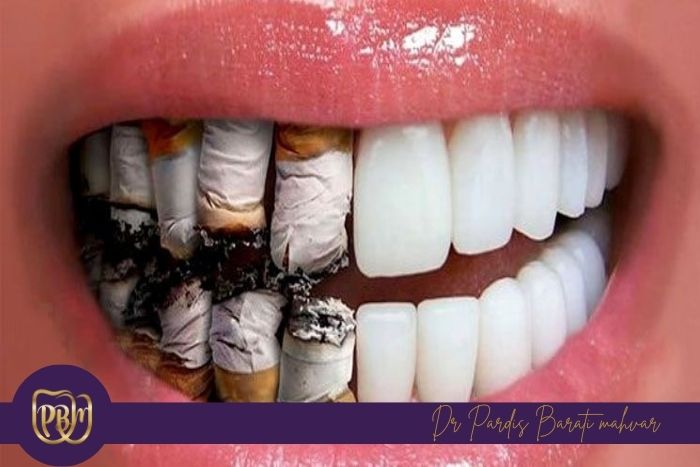 آیا بلیچینگ دندان برای افراد سیگاری مؤثر است؟