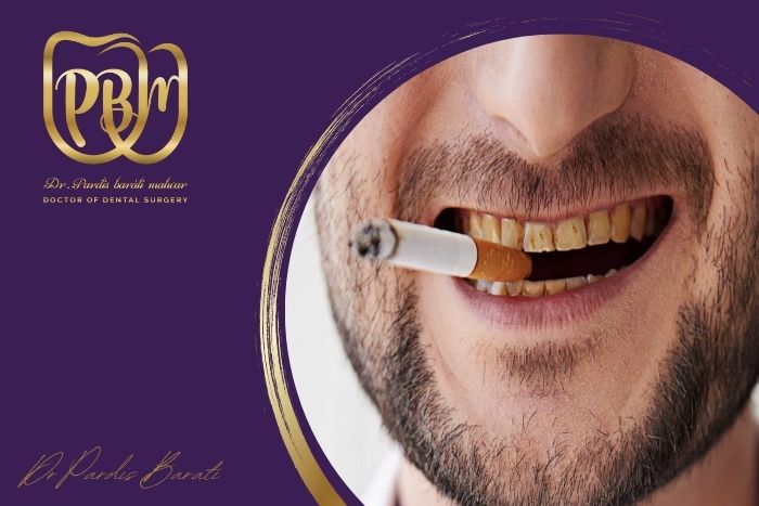 آیا بلیچینگ دندان برای افراد سیگاری هم موثر است؟