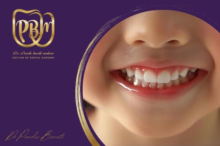 آیا بلیچینگ دندان برای نوجوانان و کودکان توصیه می ‌شود؟