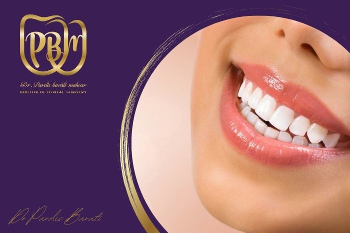 آیا بلیچینگ دندان‌ها ضرر دارد؟ هر آنچه باید بدانید