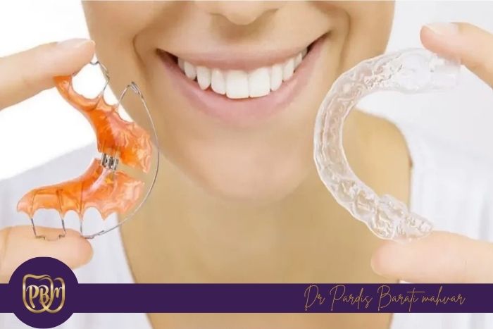 اهمیت و شیوه صحیح استفاده از ریتینر اهمیت و شیوه صحیح استفاده از ریتینر