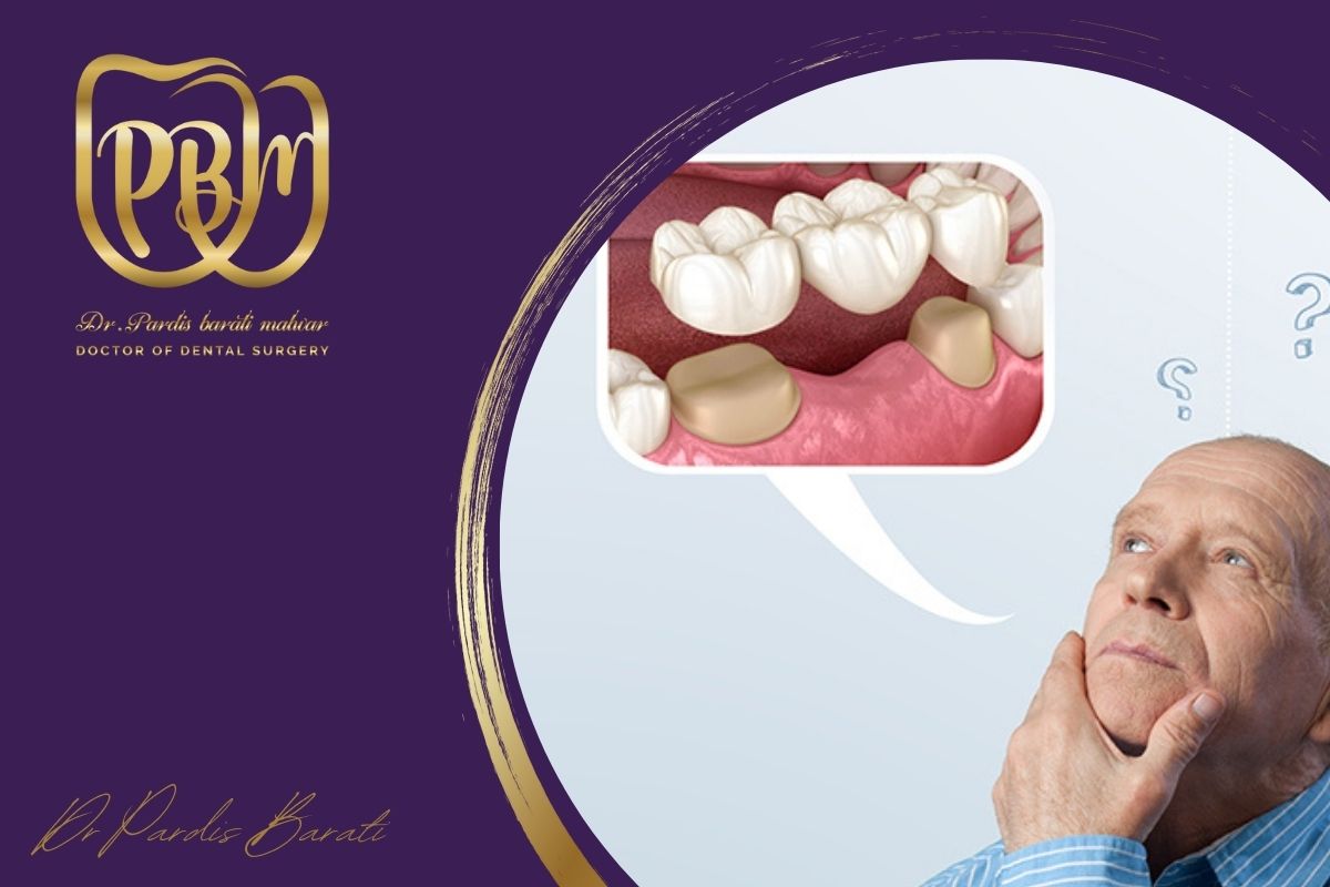 ایمپلنت دندان بهتر است یا دندان مصنوعی؟