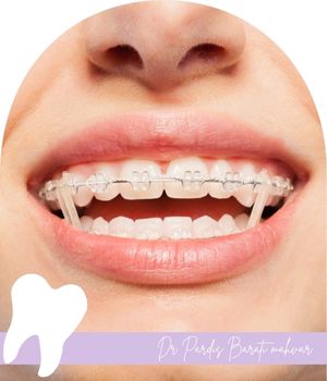 دلایل نیاز به اصلاح دندان‌ها