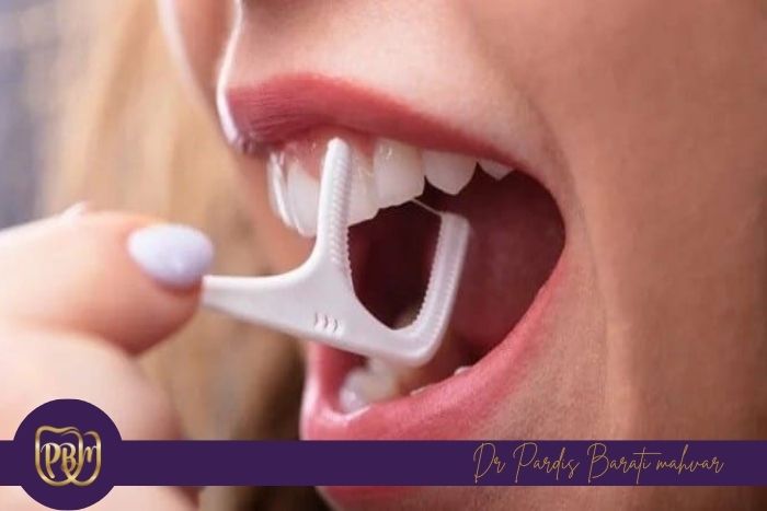 راهکارهای افزایش ماندگاری سفیدکردن دندان