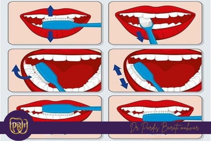 راهکارهای پیشگیری از خونریزی