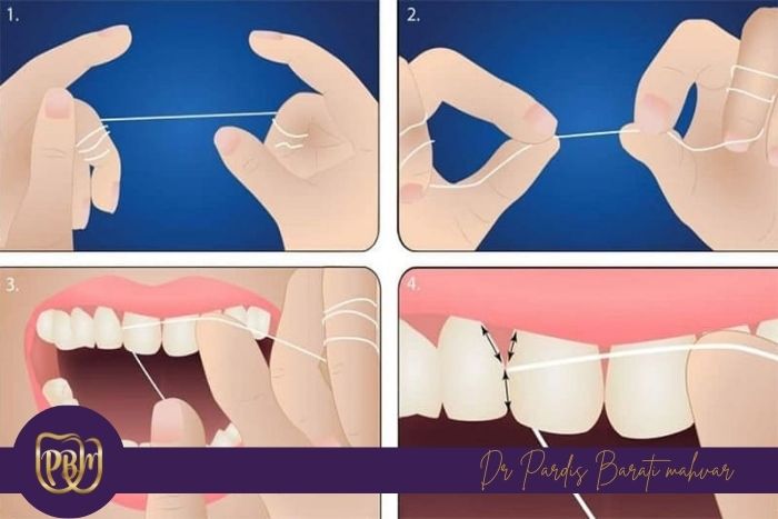 روش صحیح استفاده