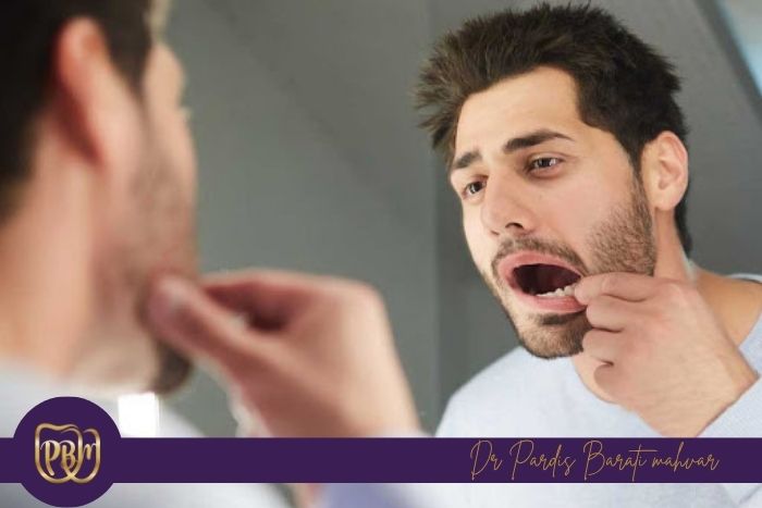 چگونه از لق شدن دندان جلوگیری کنیم؟