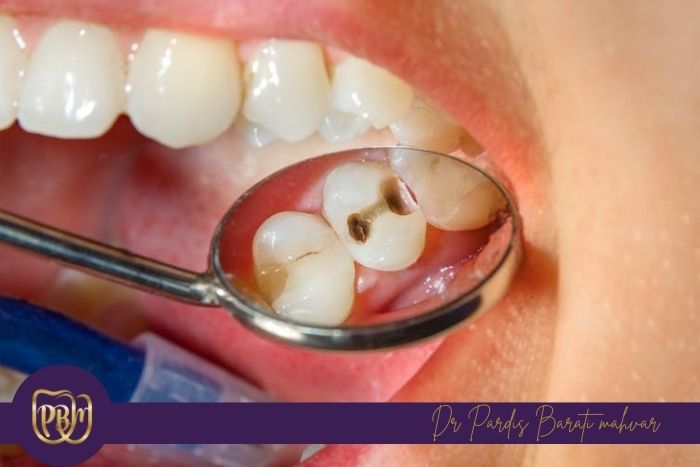 چرا انتخاب خمیر دندان مناسب اهمیت دارد؟