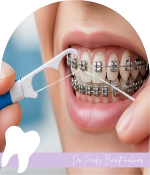 چه نوع نخ دندانی مناسب است؟