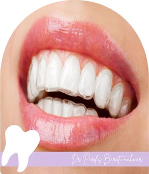 کدام روش برای شما مناسب ‌تر است؟