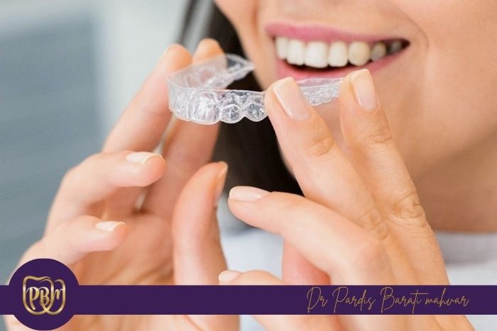 خوردن غذاهای سفت و چسبناک با الاینر چه مشکلاتی ایجاد می‌کند؟
