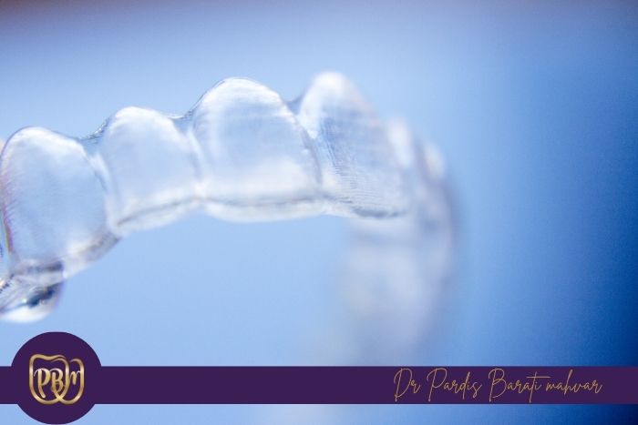 بعد از غذا چه زمانی می‌توان الاینر را دوباره در دهان گذاشت؟